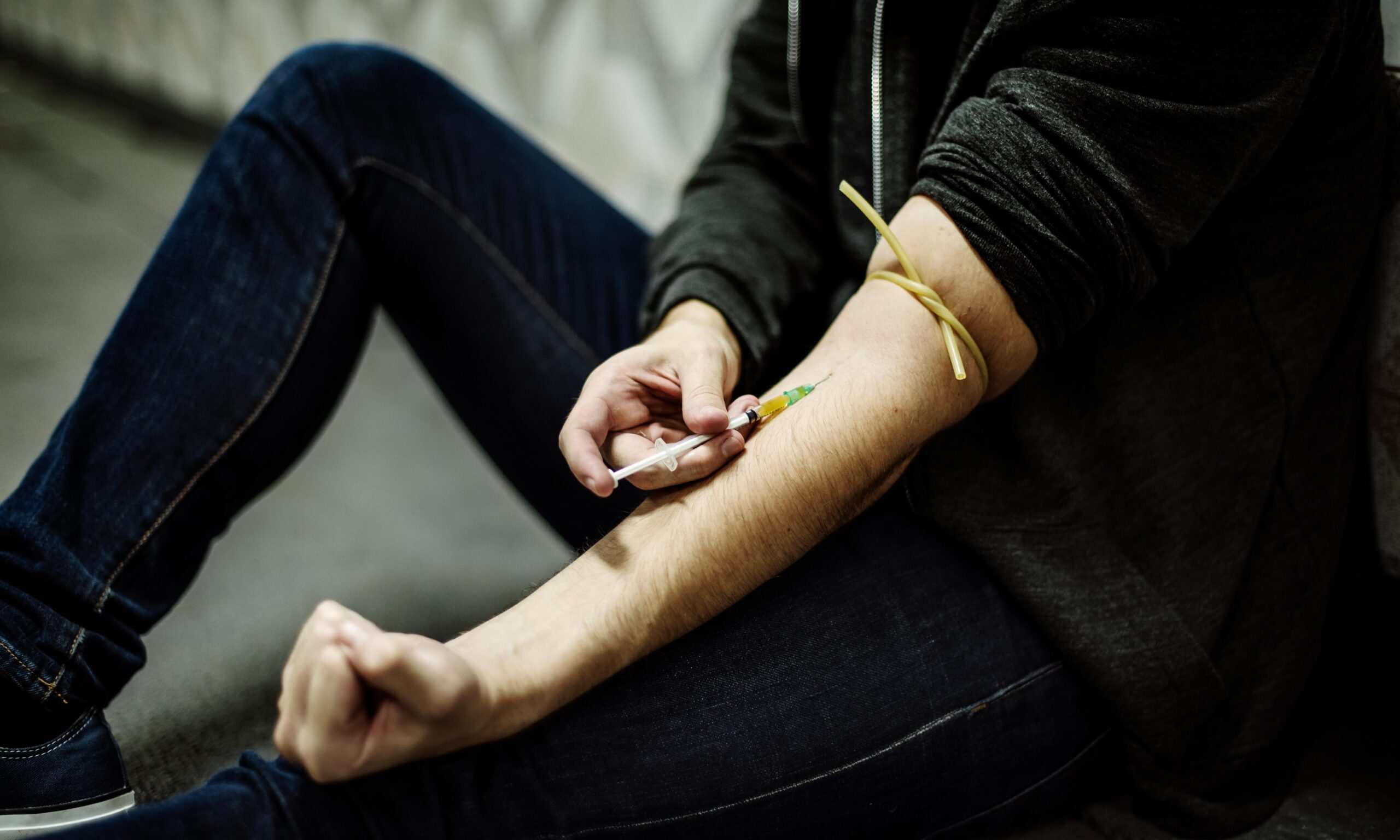 Track marks are caused by punctures to the skin related to intravenous drug use, such as heroin use, opioid drug abuse, and cocaine use.