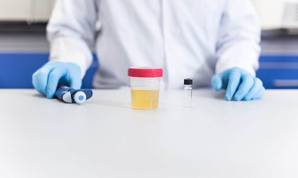  Alprazolam will remain detectable in the urine of any individual