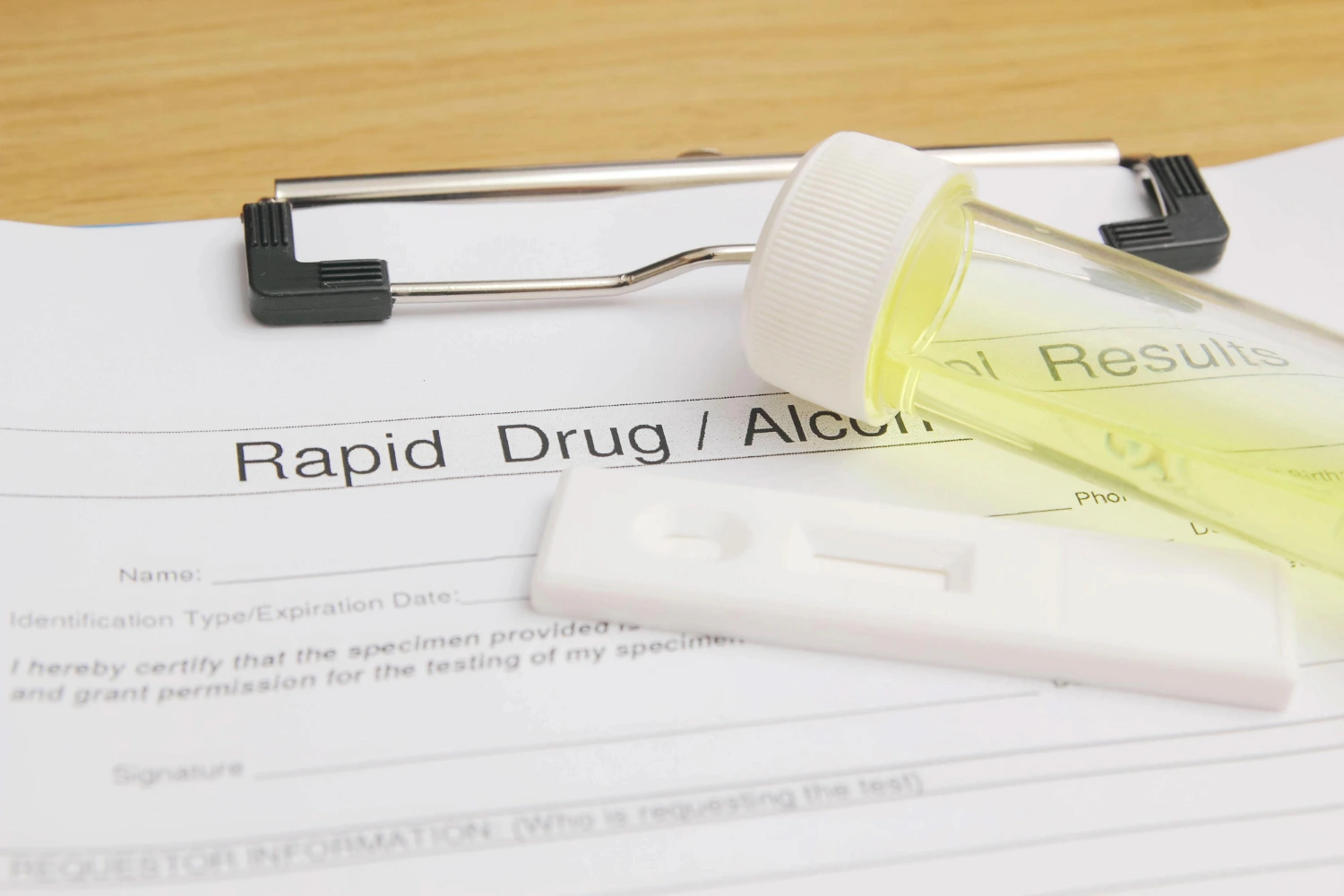 Drug test form, urine sample in vial on clipboard.